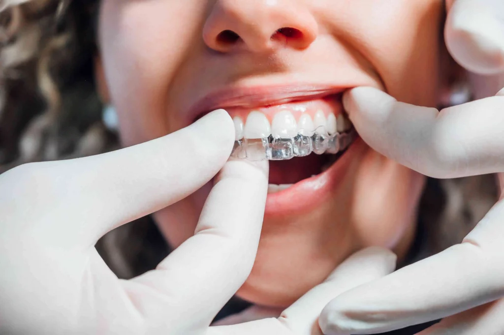 Doctor providing Invisalign treatment to the patient